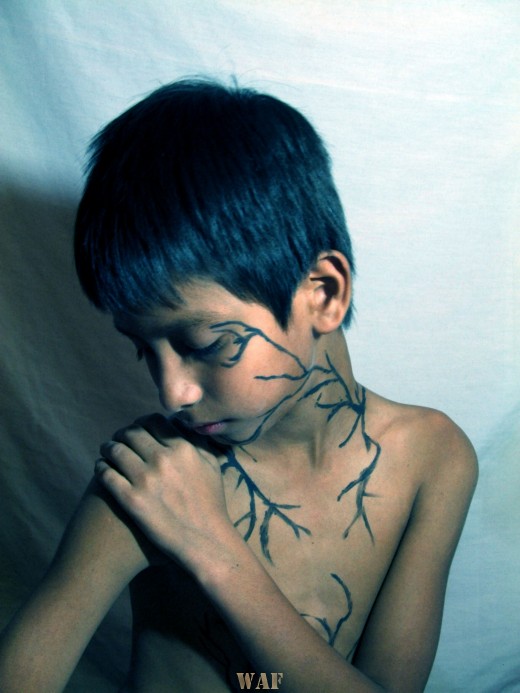 Infeccion de indiferencia